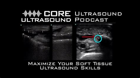 ultrasound for soft tissue aspiration